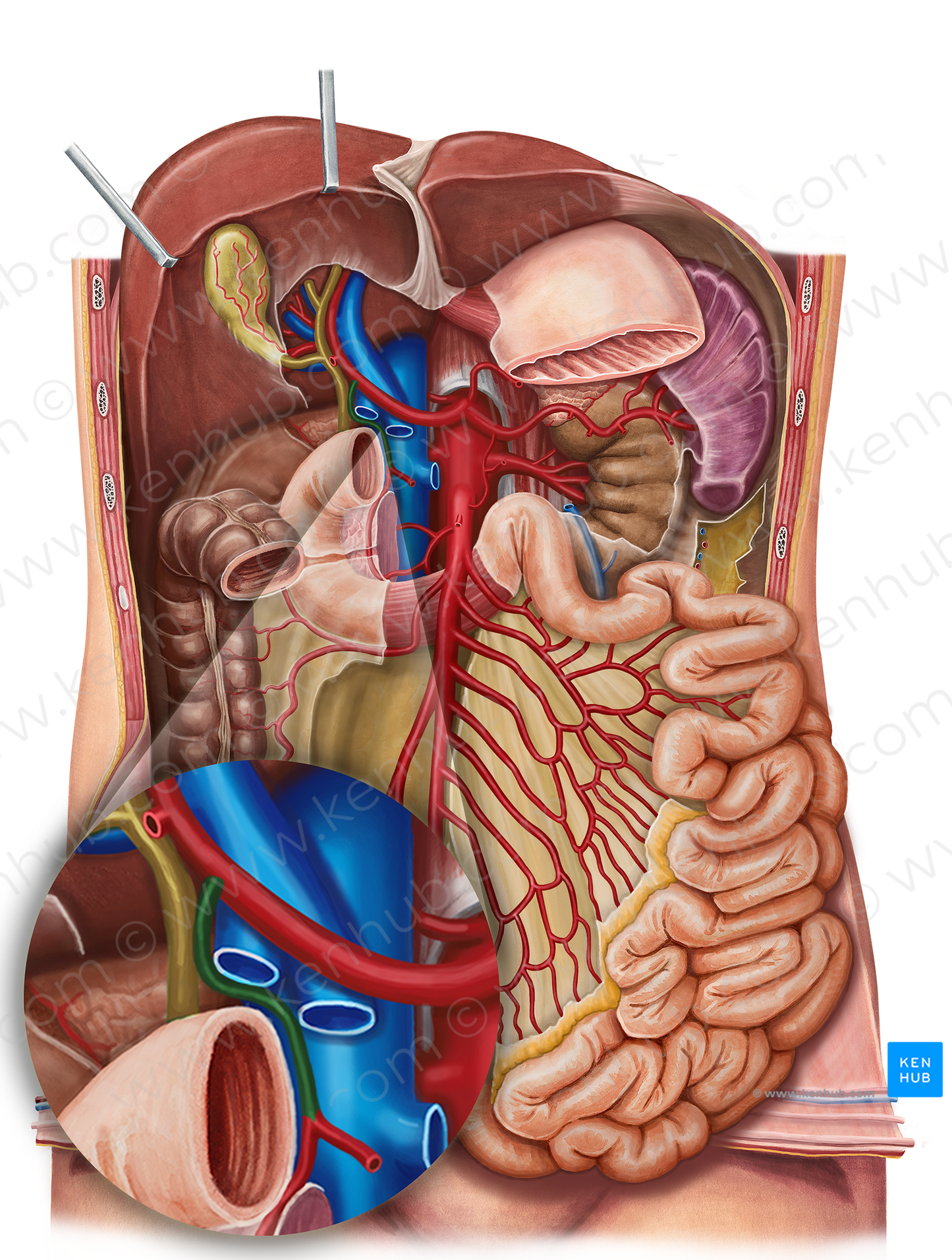 Gastroduodenal artery (#1290)