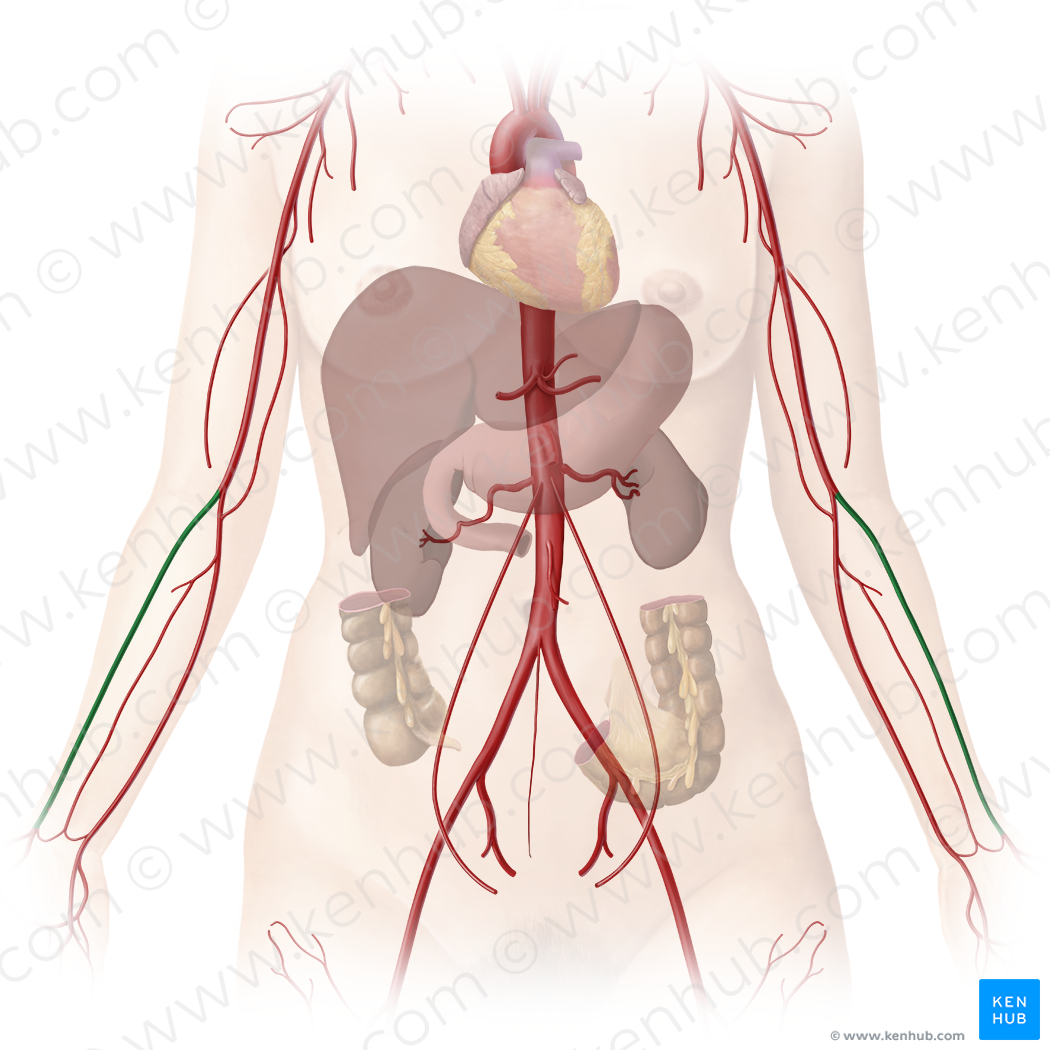 Radial artery (#1705)