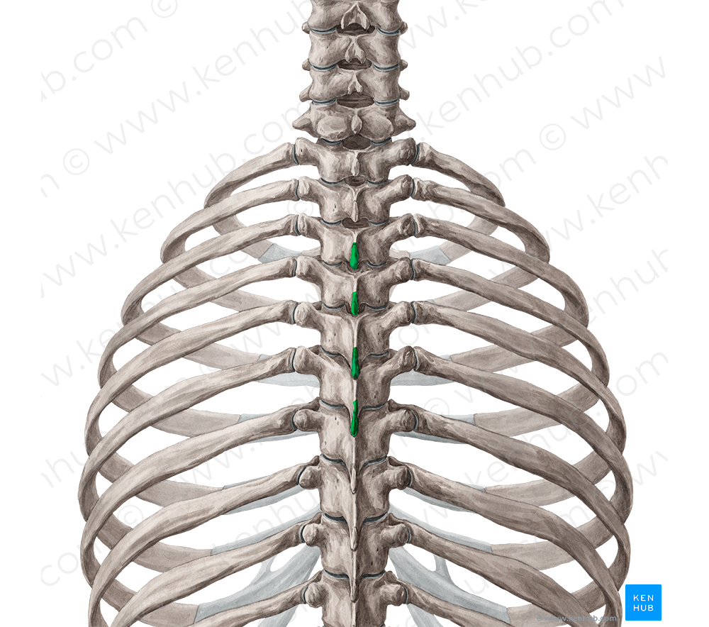 Spinous processes of vertebrae T3-T6 (#8277)