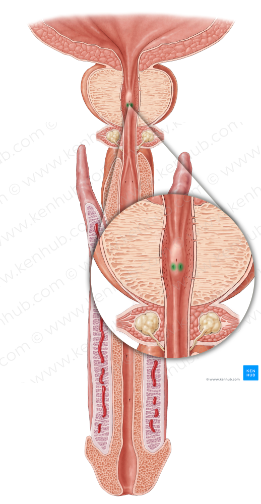 Opening of ejaculatory duct (#3313)