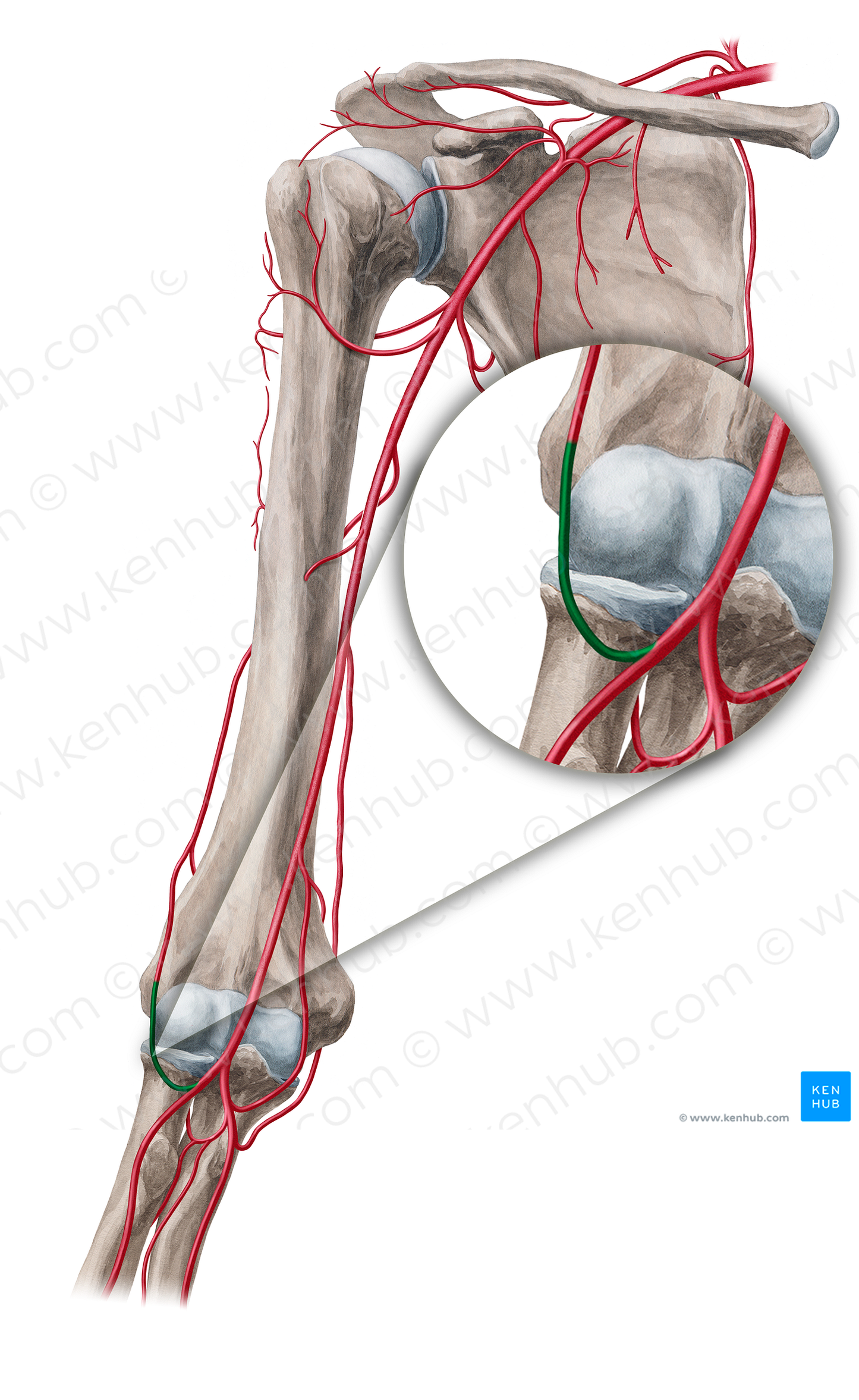 Radial recurrent artery (#18859)