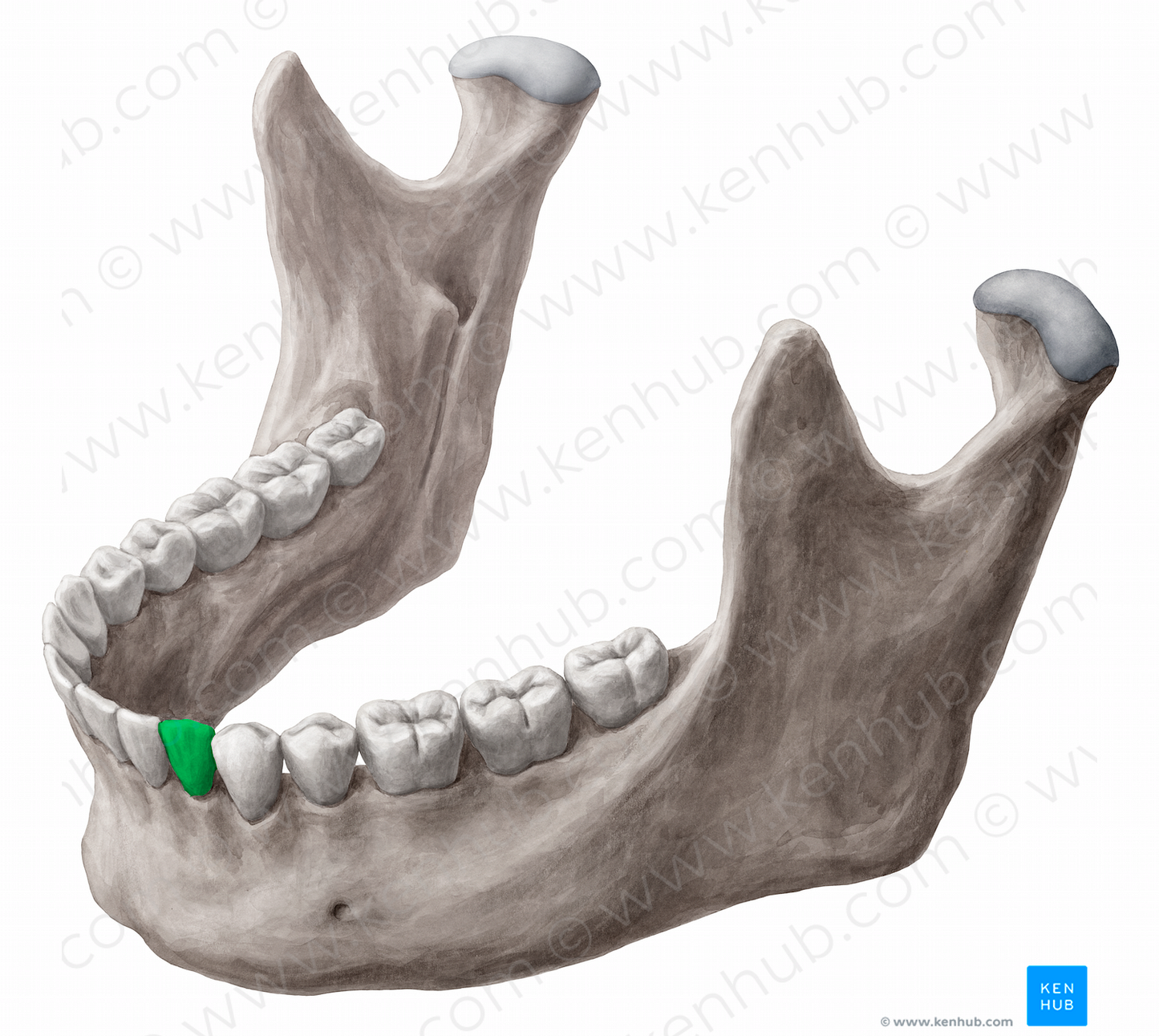 Mandibular left canine tooth (#12847)