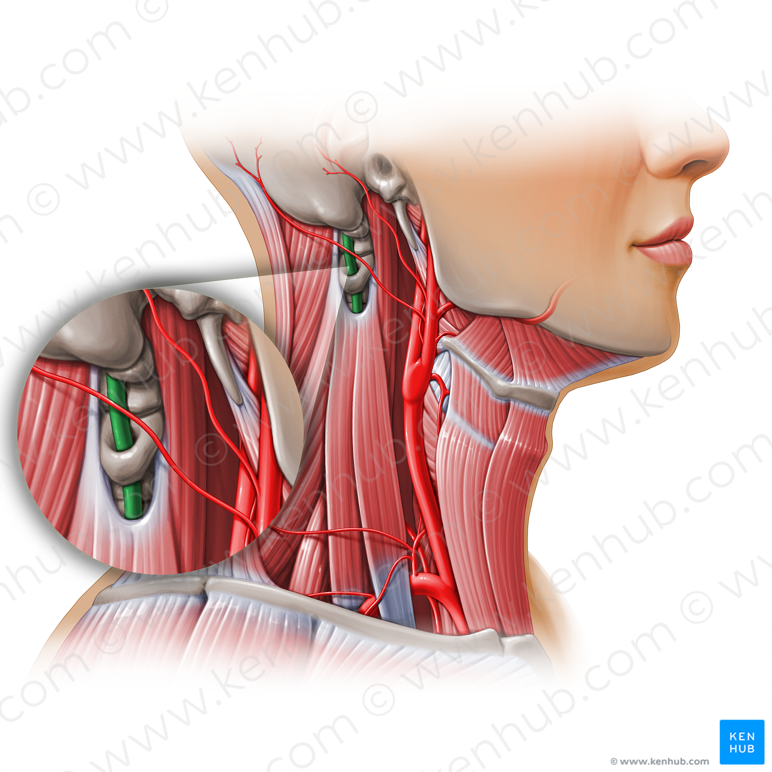 Vertebral artery (#11163)
