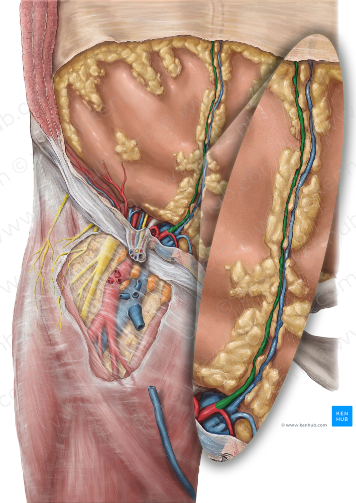 Inferior epigastric artery (#1185)