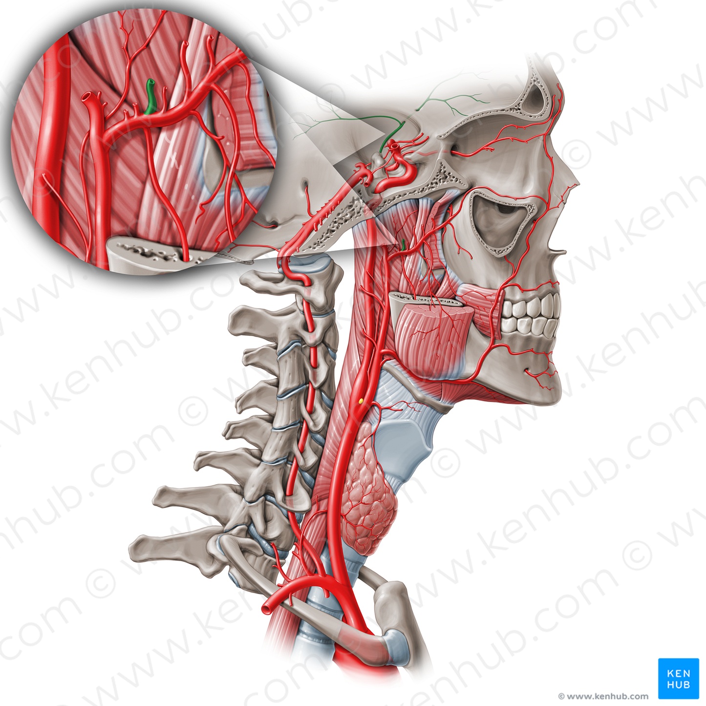 Middle meningeal artery (#1511)