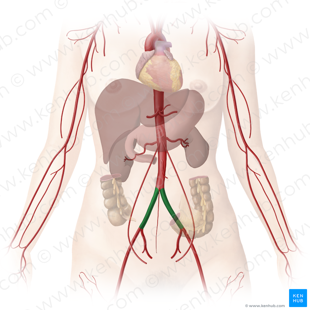 Common iliac artery (#1366)