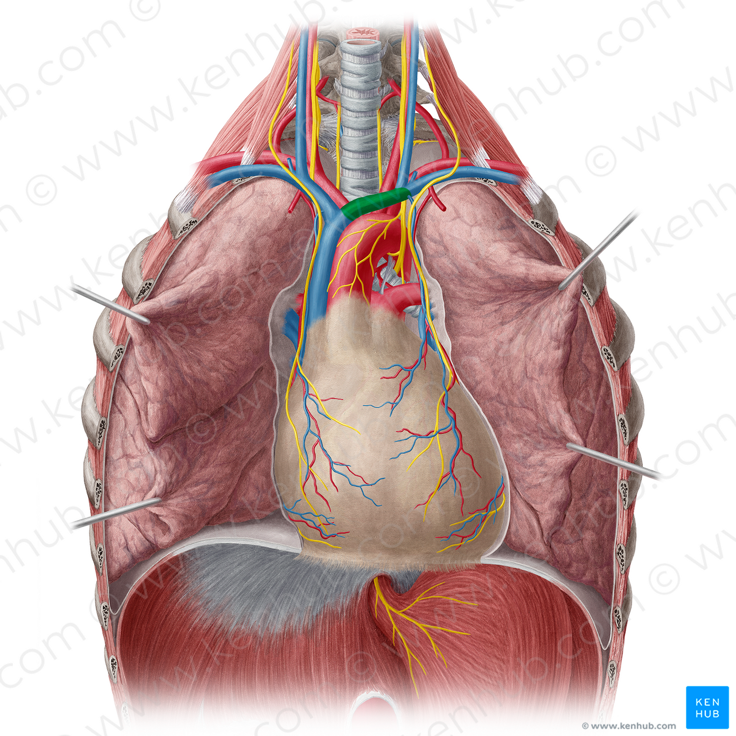 Left brachiocephalic vein (#10013)