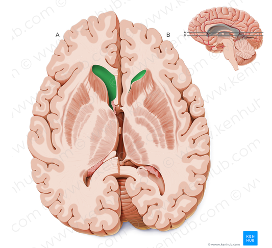 Frontal horn of lateral ventricle (#2853)