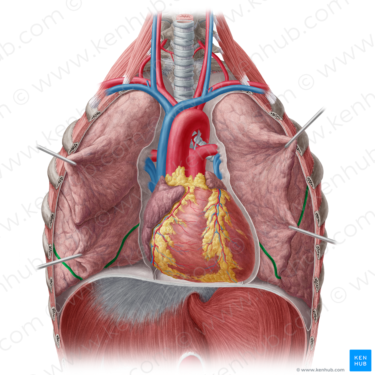 Oblique fissure of lung (#3665)