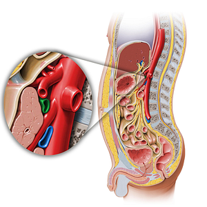 Splenic vein (#10589)