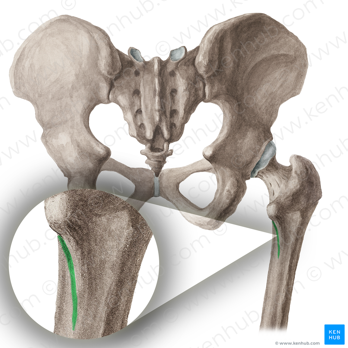 Spiral line of femur (#16439)