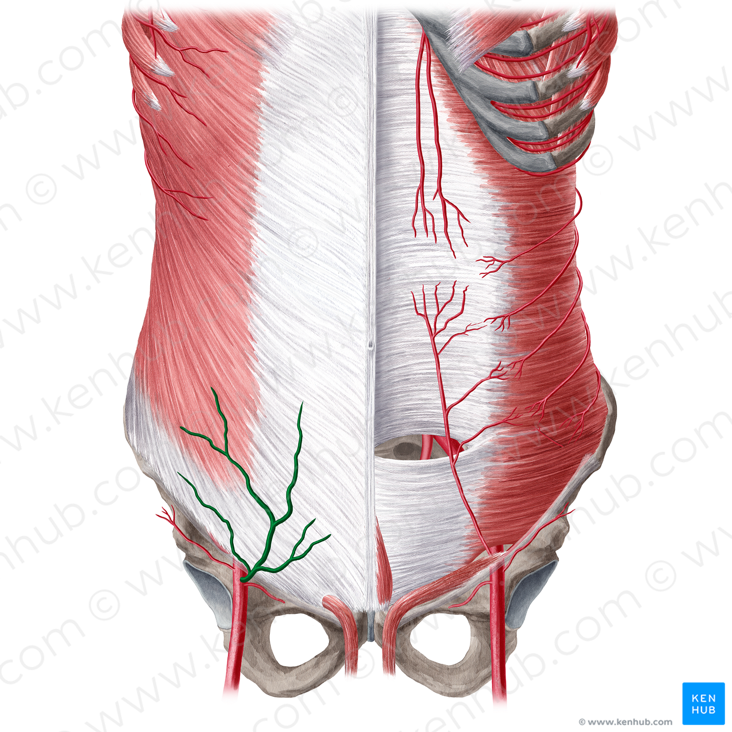 Superficial epigastric artery (#21564)