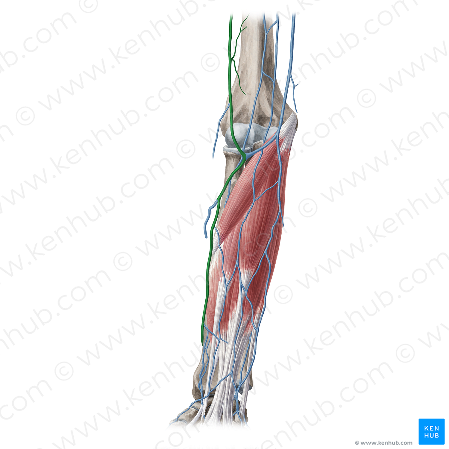 Cephalic vein (#10105)