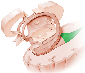 Occipital horn of lateral ventricle (#2869)