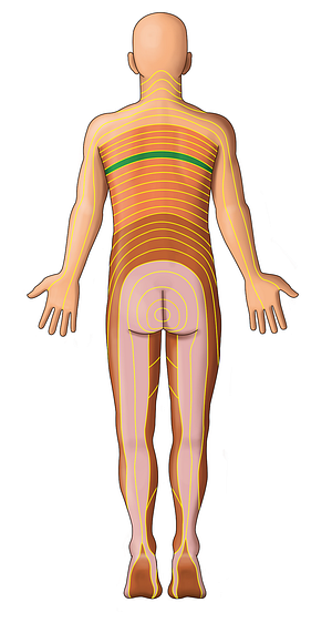 T5 dermatome (#13047)