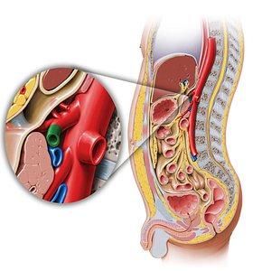 Splenic artery (#1799)