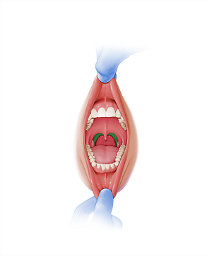 Palatopharyngeal arch (#844)