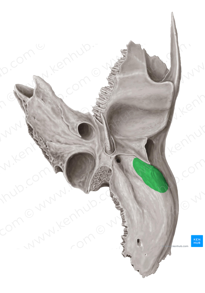 Mastoid process of temporal bone (#8225)