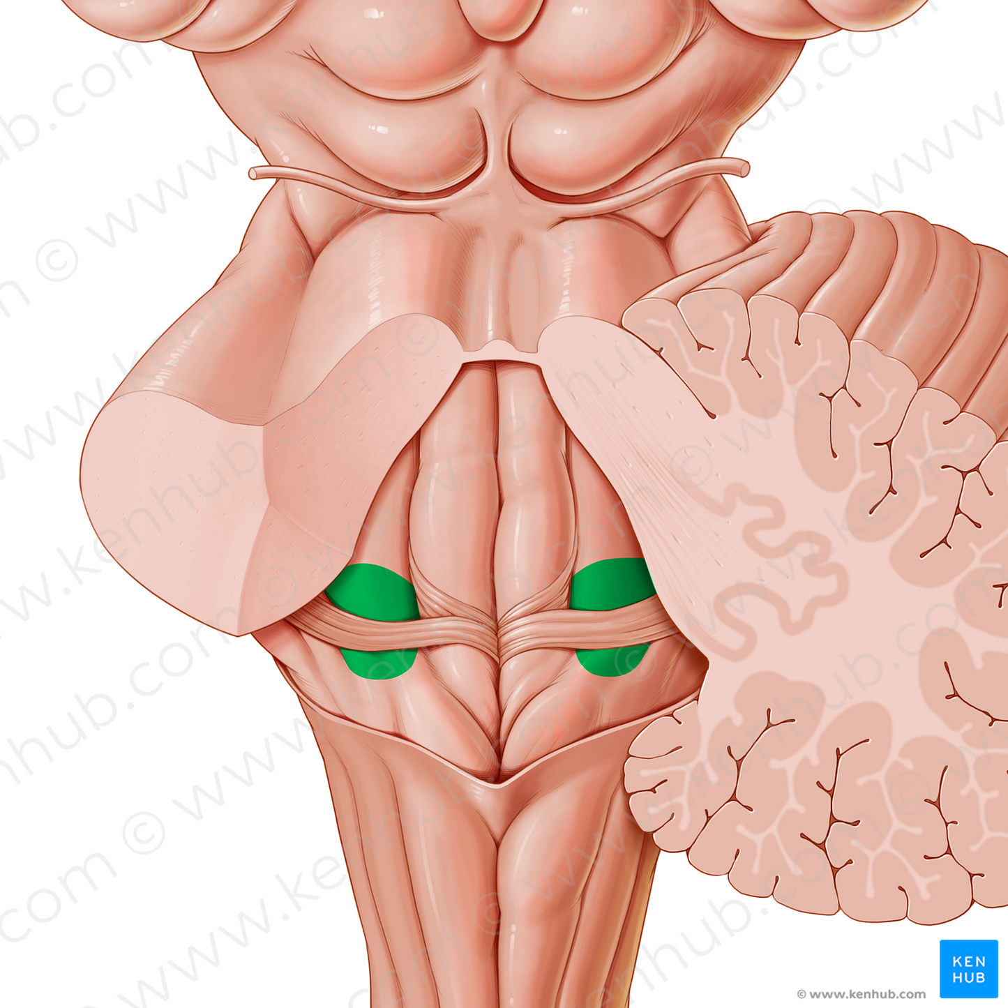 Vestibular area of fourth ventricle (#872)