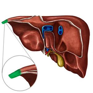 Fibrous appendix of liver (#793)