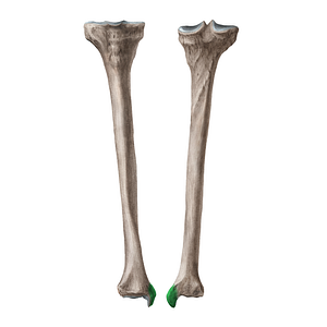 Medial malleolus of tibia (#21950)