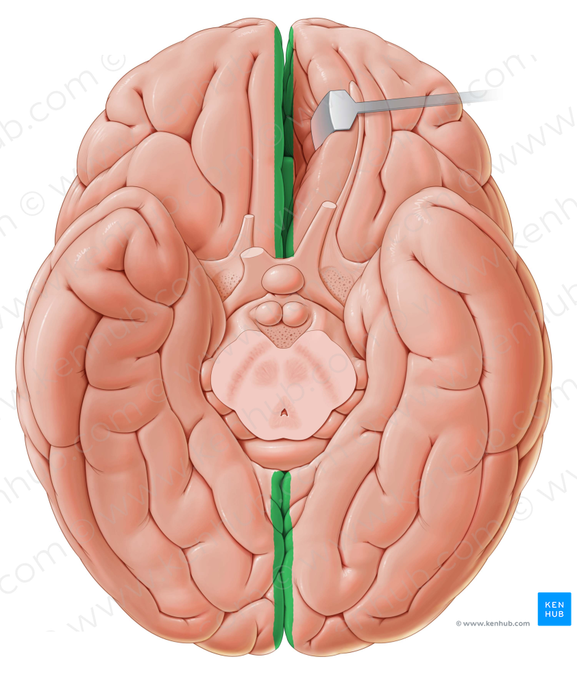 Longitudinal cerebral fissure (#3659)