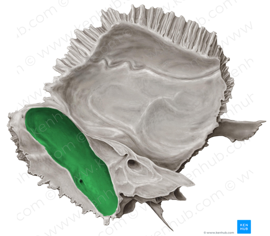 Groove for sigmoid sinus of temporal bone (#9322)