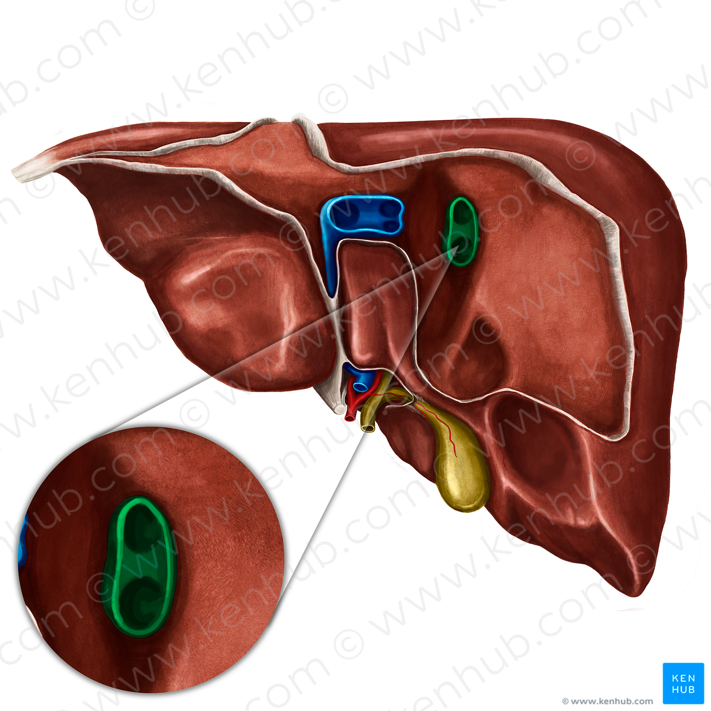 Right hepatic vein (#10274)