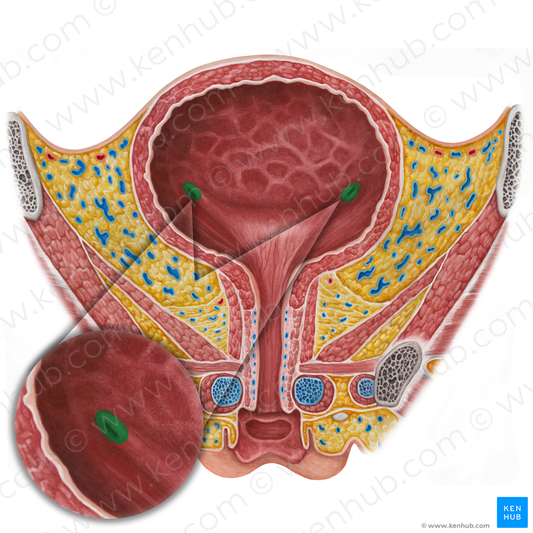 Ureteric orifice (#19133)