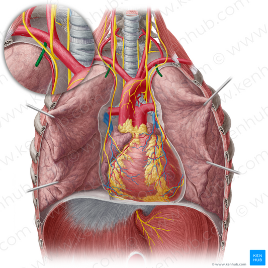 Internal thoracic artery (#1909)