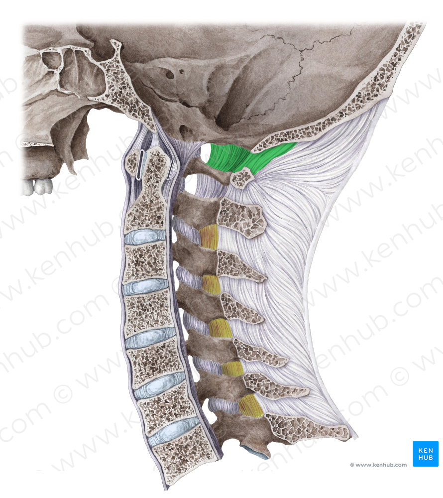 Posterior atlantooccipital membrane (#5034)