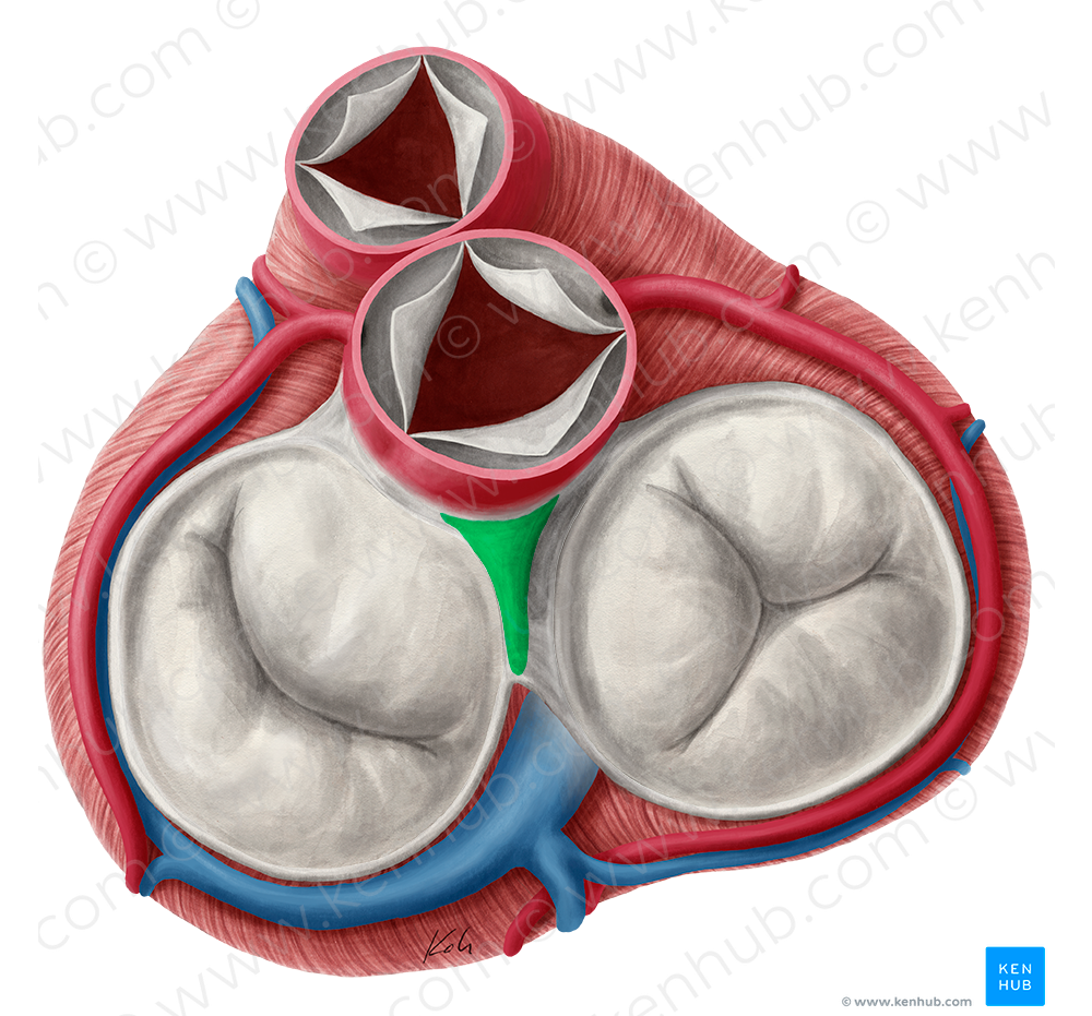 Right fibrous trigone (#9547)