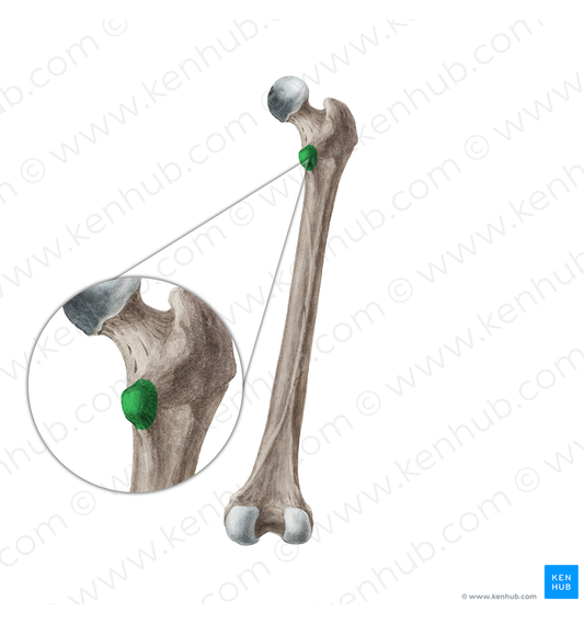 Lesser trochanter of femur (#19959)