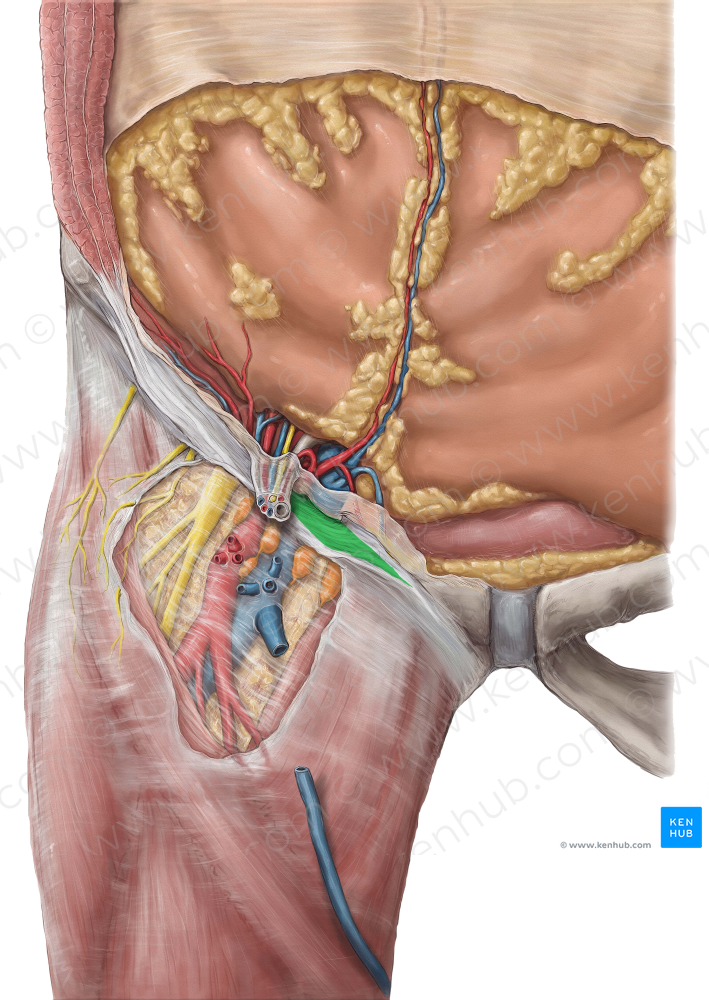 Lacunar ligament (#4563)