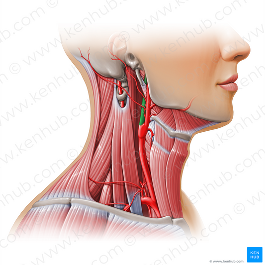 Right internal carotid artery (#11134)