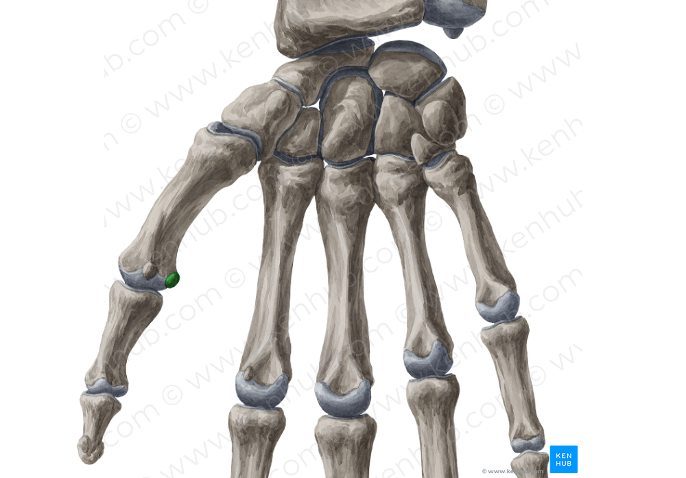 Ulnar sesamoid bone of metacarpophalangeal joint of thumb (#7509)