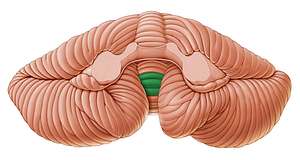 Uvula of vermis (#9878)