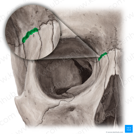 Frontomaxillary suture (#21456)