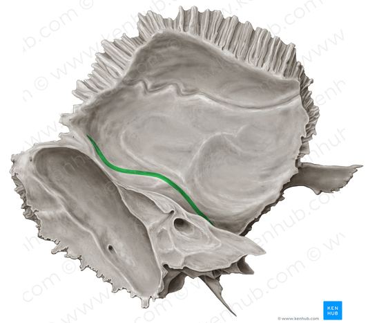 Petrosquamous fissure (#19689)