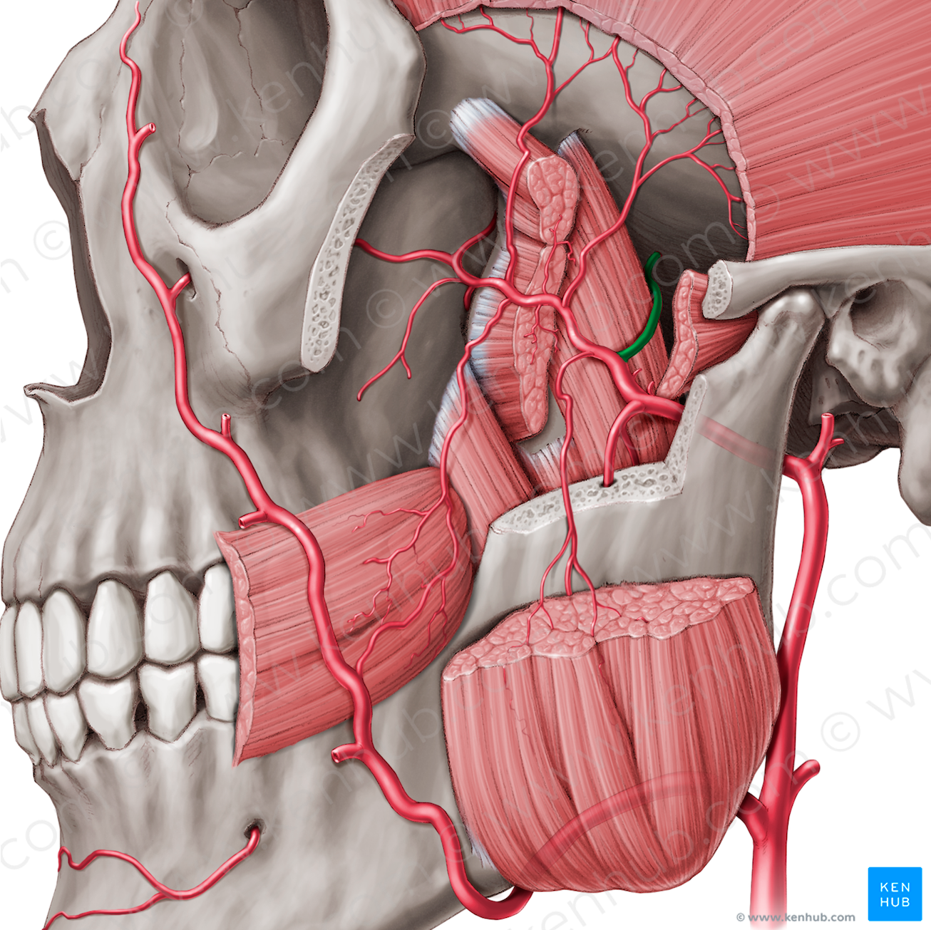 Middle meningeal artery (#1510)