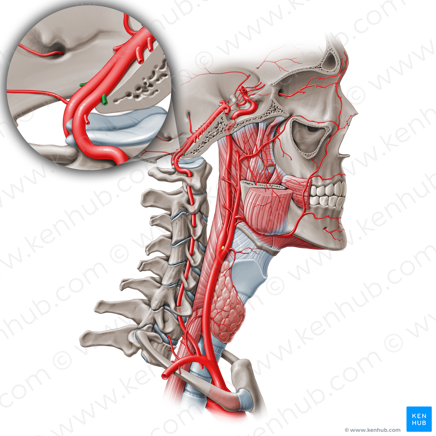 Posterior inferior cerebellar artery (#1004)