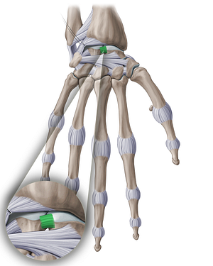 Scapholunate interosseous ligament (#18909)