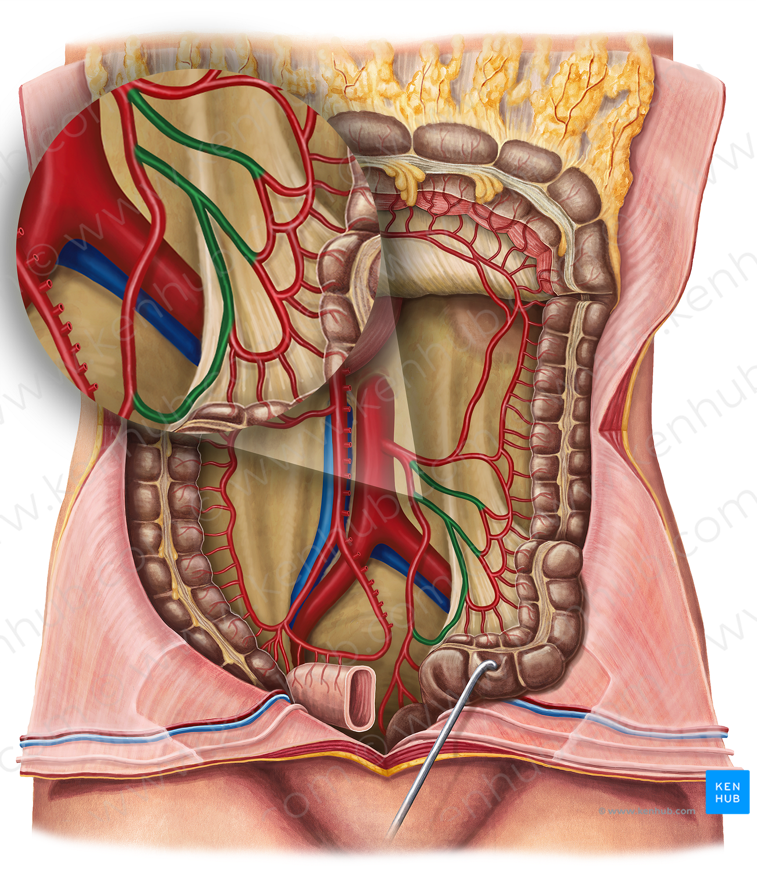 Sigmoid arteries (#1212)