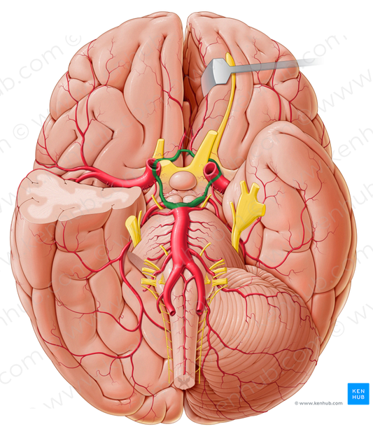 Cerebral arterial circle (of Willis) (#2622)