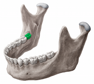 Mandibular right third molar tooth (#12858)