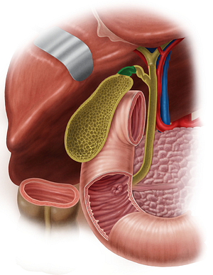 Neck of gallbladder (#2697)