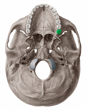 Maxillary left third molar tooth (#12841)