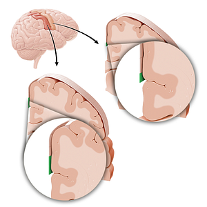 Sensory and motor cortex of genitals (#21219)