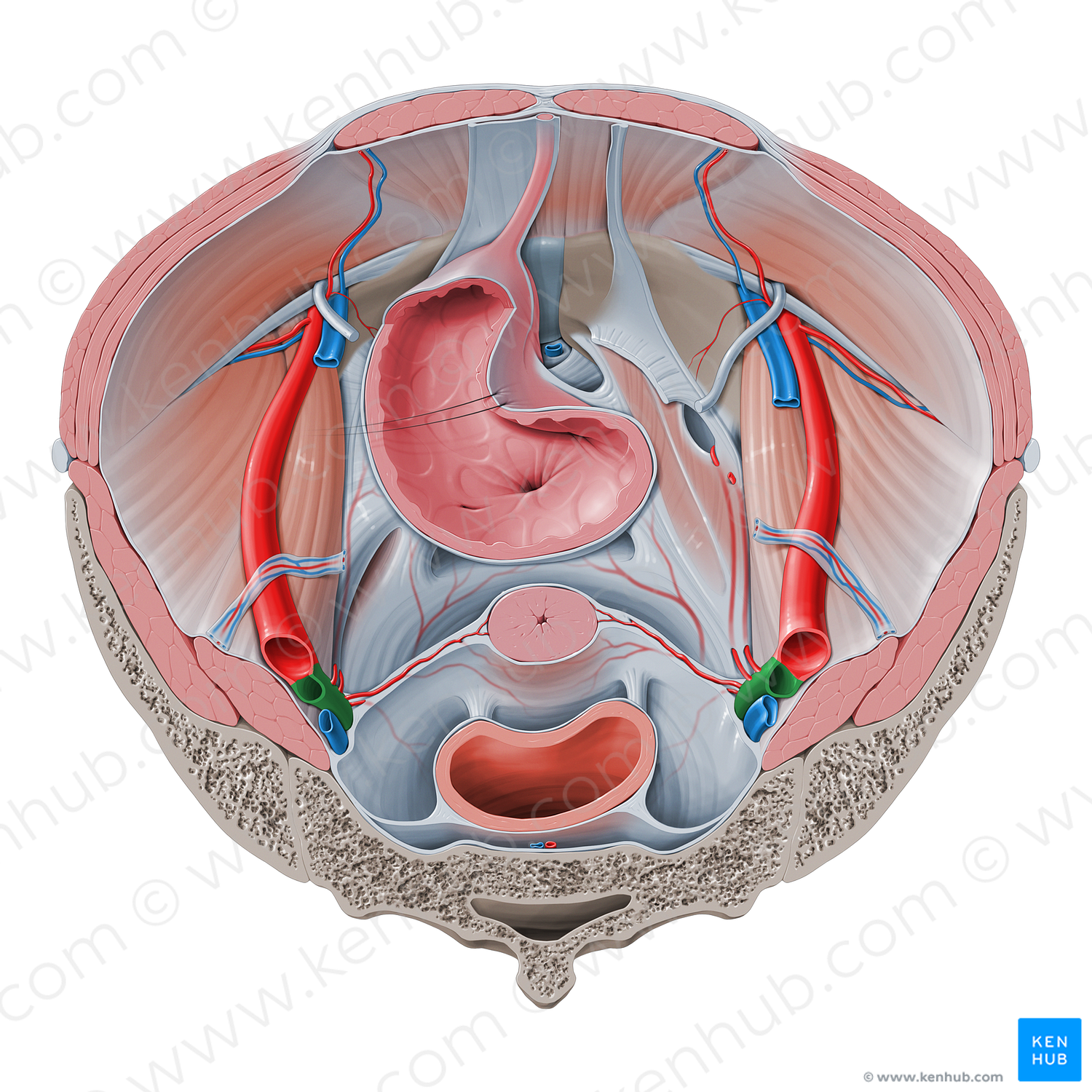 Internal iliac artery (#1425)