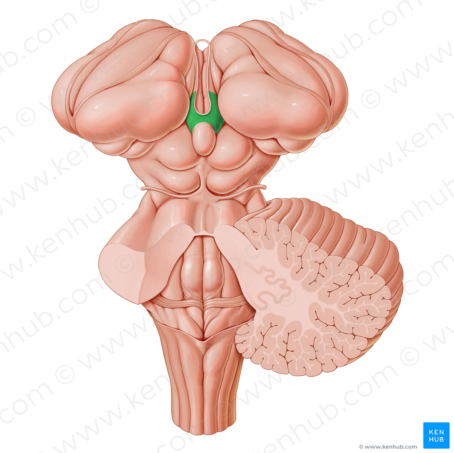 Habenular trigone (#9551)